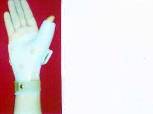 ortéza zápästia fixačná z plastu