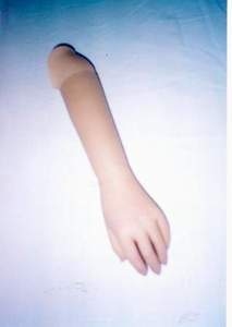 protéza ruky kozmetická ulpievacia